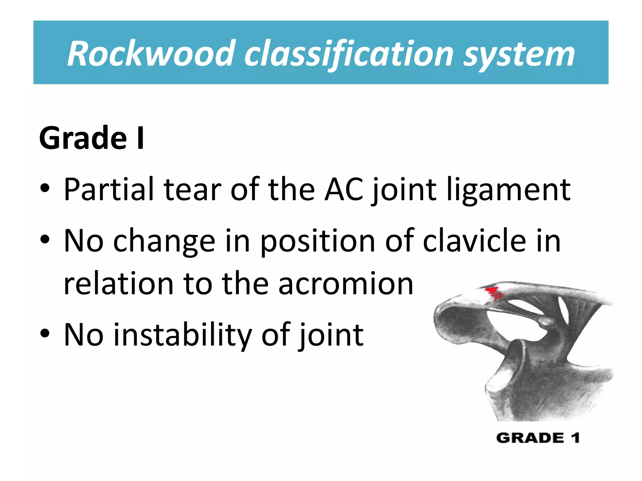 Rockwood classification system
Rockwood classification system
Grade I
• Partial tear of the AC joint ligament
• No change in position of clavicle in
relation to the acromion
• No instability of joint
 