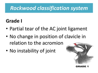Rockwood classification system
Rockwood classification system
Grade I
• Partial tear of the AC joint ligament
• No change in position of clavicle in
relation to the acromion
• No instability of joint
 