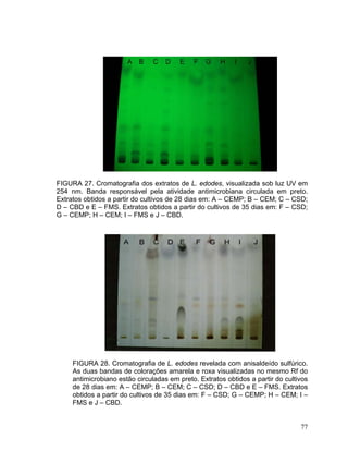 FIGURA 27. Cromatografia dos extratos de L. edodes, visualizada sob luz UV em
254 nm. Banda responsável pela atividade antimicrobiana circulada em preto.
Extratos obtidos a partir do cultivos de 28 dias em: A – CEMP; B – CEM; C – CSD;
D – CBD e E – FMS. Extratos obtidos a partir do cultivos de 35 dias em: F – CSD;
G – CEMP; H – CEM; I – FMS e J – CBD.




     FIGURA 28. Cromatografia de L. edodes revelada com anisaldeído sulfúrico.
     As duas bandas de colorações amarela e roxa visualizadas no mesmo Rf do
     antimicrobiano estão circuladas em preto. Extratos obtidos a partir do cultivos
     de 28 dias em: A – CEMP; B – CEM; C – CSD; D – CBD e E – FMS. Extratos
     obtidos a partir do cultivos de 35 dias em: F – CSD; G – CEMP; H – CEM; I –
     FMS e J – CBD.


                                                                                 77
 