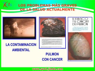 LA CONTAMINACION
AMBIENTAL
PULMON
CON CANCER
LOS PROBLEMAS MÁS GRAVES
DE LA SALUD ACTUALMENTE
 