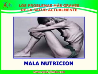 MALA NUTRICION
LOS PROBLEMAS MÁS GRAVES
DE LA SALUD ACTUALMENTE
 