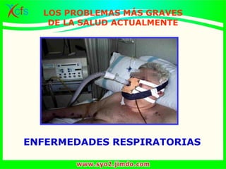 ENFERMEDADES RESPIRATORIAS
LOS PROBLEMAS MÁS GRAVES
DE LA SALUD ACTUALMENTE
 