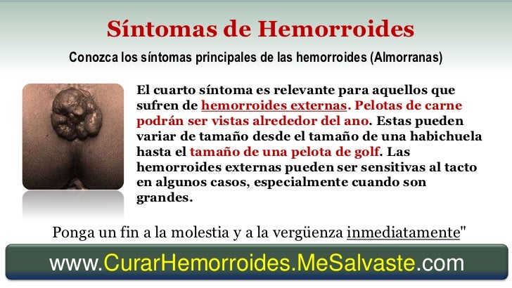 De que se agrietan las uñas en las manos y como curar