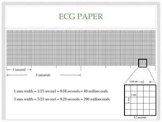 ECG | PPTX