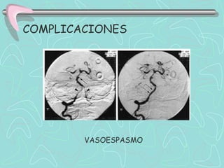 COMPLICACIONES




        VASOESPASMO
 