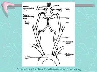Sites of predilection for atherosclerotic narrowing
 