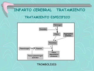 INFARTO CEREBRAL       TRATAMIENTO
    TRATAMIENTO ESPECIFICO




         TROMBOLISIS
 