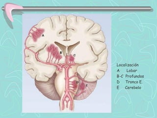 Localización
A    Lobar
B-C Profundos
D Tronco E.
E Cerebelo
 