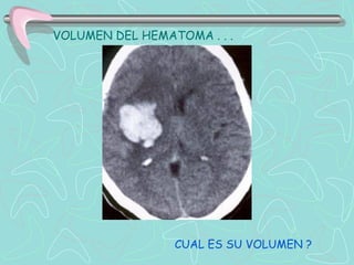 VOLUMEN DEL HEMATOMA . . .




                 CUAL ES SU VOLUMEN ?
 