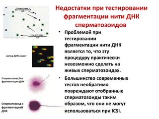 Недостатки при тестировании
фрагментации нити ДНК
сперматозоидов
• Проблемой при
тестировании
фрагментации нити ДНК
является то, что эту
процедуру практически
невозможно сделать на
живых сперматозоидах.
• Большинство современных
тестов необратимо
повреждают отобранные
сперматозоиды таким
образом, что они не могут
использоваться при ICSI.
Сперматозоид без
фрагментации ДНК
Сперматозоид с
фрагментацией
ДНК
метод ДНК-комет
 