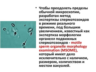 • Чтобы преодолеть пределы
обычной микроскопии,
разработан метод
экспертизы сперматозоидов
в режиме реального
времени, под большим
увеличением, известный как
экспертиза морфологии
органелл подвижных
сперматозоидов - motile
sperm organelle morphology
examination (MSOME),
который имеет дело
исключительно с наличием,
размером, количеством и
местом вакуолей.
 