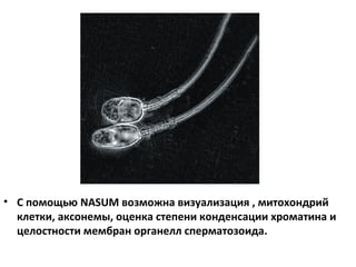 • С помощью NASUM возможна визуализация , митохондрий
клетки, аксонемы, оценка степени конденсации хроматина и
целостности мембран органелл сперматозоида.
 
