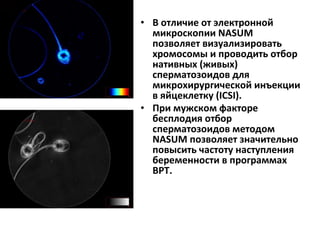 • В отличие от электронной
микроскопии NASUM
позволяет визуализировать
хромосомы и проводить отбор
нативных (живых)
сперматозоидов для
микрохирургической инъекции
в яйцеклетку (ICSI).
• При мужском факторе
бесплодия отбор
сперматозоидов методом
NASUM позволяет значительно
повысить частоту наступления
беременности в программах
ВРТ.
 