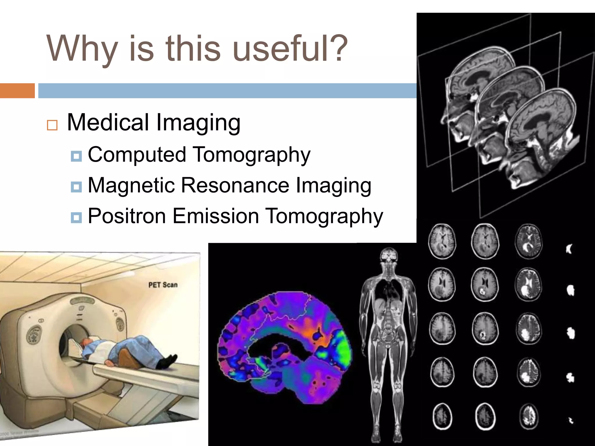 Why is this useful?
   Medical Imaging
     Computed  Tomography
     Magnetic Resonance Imaging

     Positron Emission Tomography
 