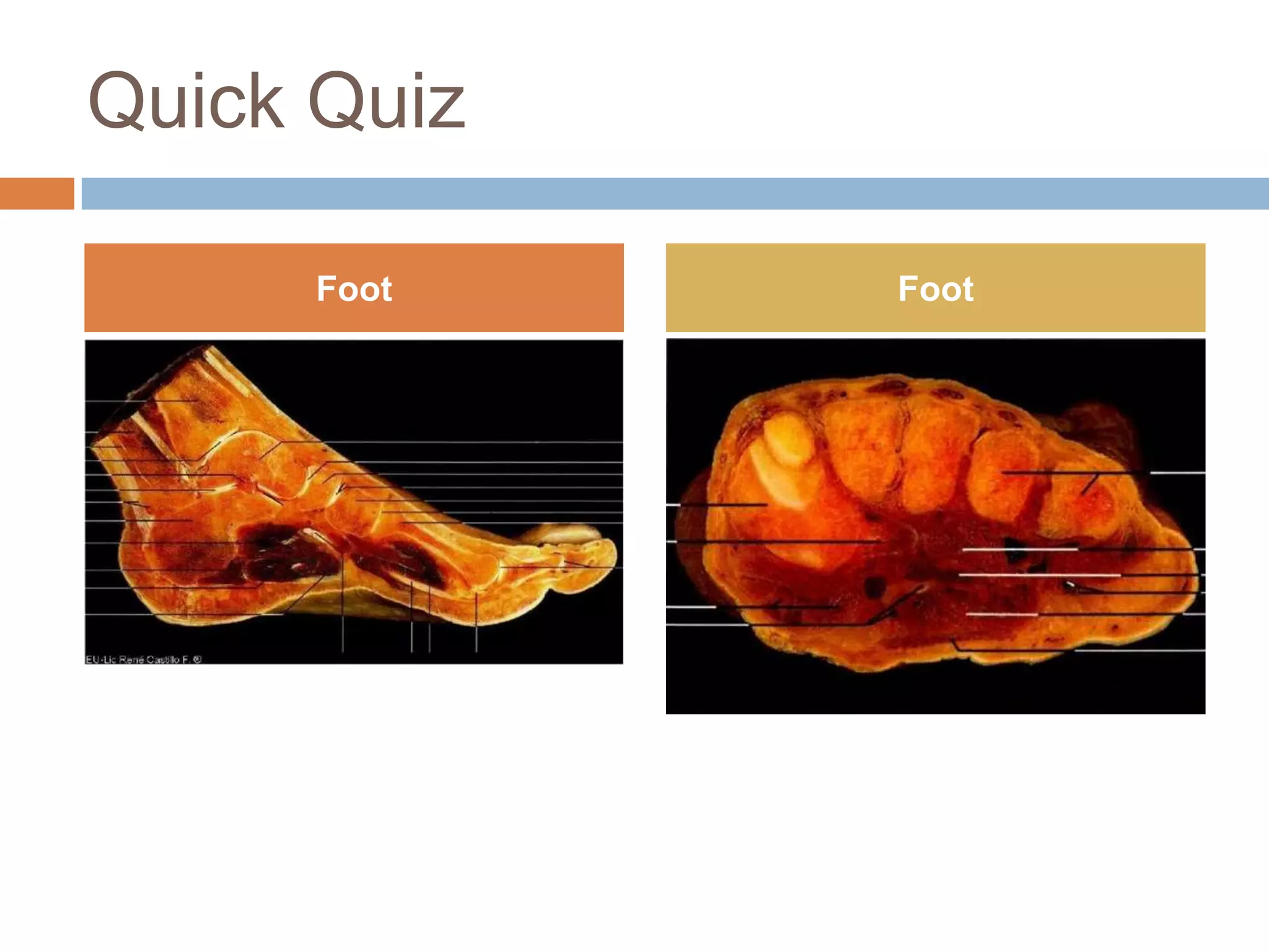 Quick Quiz

      Foot   Foot
 