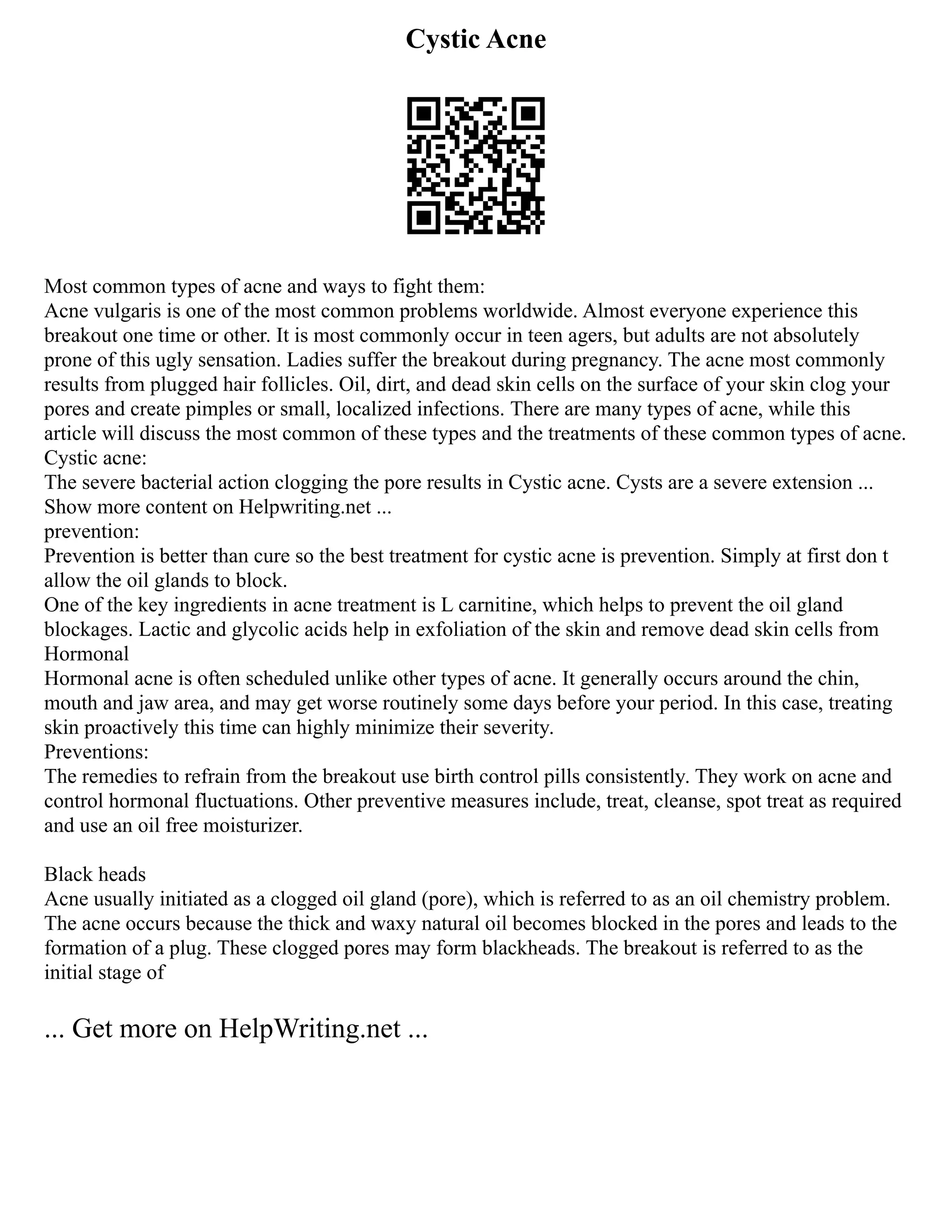 Cystic Acne
Most common types of acne and ways to fight them:
Acne vulgaris is one of the most common problems worldwide. Almost everyone experience this
breakout one time or other. It is most commonly occur in teen agers, but adults are not absolutely
prone of this ugly sensation. Ladies suffer the breakout during pregnancy. The acne most commonly
results from plugged hair follicles. Oil, dirt, and dead skin cells on the surface of your skin clog your
pores and create pimples or small, localized infections. There are many types of acne, while this
article will discuss the most common of these types and the treatments of these common types of acne.
Cystic acne:
The severe bacterial action clogging the pore results in Cystic acne. Cysts are a severe extension ...
Show more content on Helpwriting.net ...
prevention:
Prevention is better than cure so the best treatment for cystic acne is prevention. Simply at first don t
allow the oil glands to block.
One of the key ingredients in acne treatment is L carnitine, which helps to prevent the oil gland
blockages. Lactic and glycolic acids help in exfoliation of the skin and remove dead skin cells from
Hormonal
Hormonal acne is often scheduled unlike other types of acne. It generally occurs around the chin,
mouth and jaw area, and may get worse routinely some days before your period. In this case, treating
skin proactively this time can highly minimize their severity.
Preventions:
The remedies to refrain from the breakout use birth control pills consistently. They work on acne and
control hormonal fluctuations. Other preventive measures include, treat, cleanse, spot treat as required
and use an oil free moisturizer.
Black heads
Acne usually initiated as a clogged oil gland (pore), which is referred to as an oil chemistry problem.
The acne occurs because the thick and waxy natural oil becomes blocked in the pores and leads to the
formation of a plug. These clogged pores may form blackheads. The breakout is referred to as the
initial stage of
... Get more on HelpWriting.net ...
 
