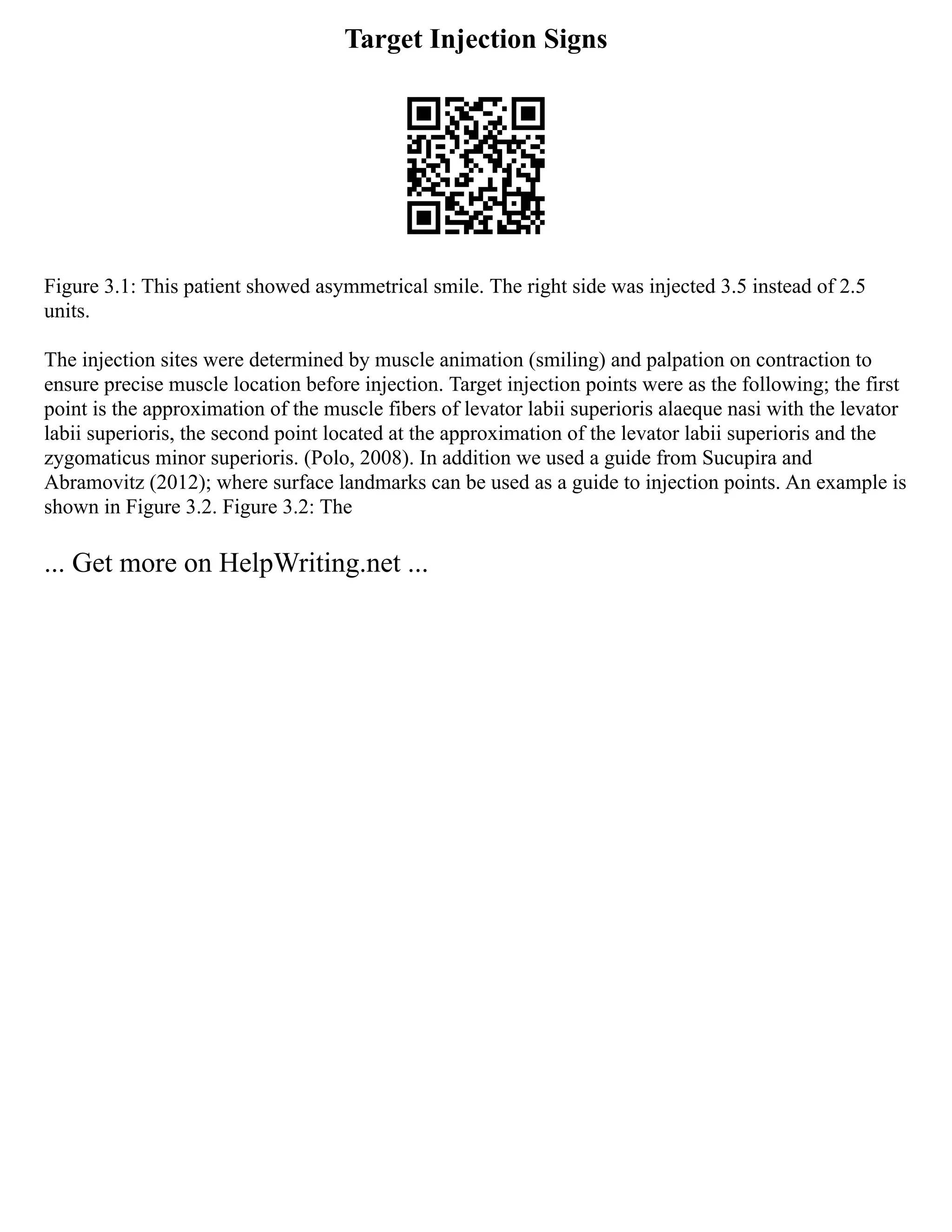 Target Injection Signs
Figure 3.1: This patient showed asymmetrical smile. The right side was injected 3.5 instead of 2.5
units.
The injection sites were determined by muscle animation (smiling) and palpation on contraction to
ensure precise muscle location before injection. Target injection points were as the following; the first
point is the approximation of the muscle fibers of levator labii superioris alaeque nasi with the levator
labii superioris, the second point located at the approximation of the levator labii superioris and the
zygomaticus minor superioris. (Polo, 2008). In addition we used a guide from Sucupira and
Abramovitz (2012); where surface landmarks can be used as a guide to injection points. An example is
shown in Figure 3.2. Figure 3.2: The
... Get more on HelpWriting.net ...
 