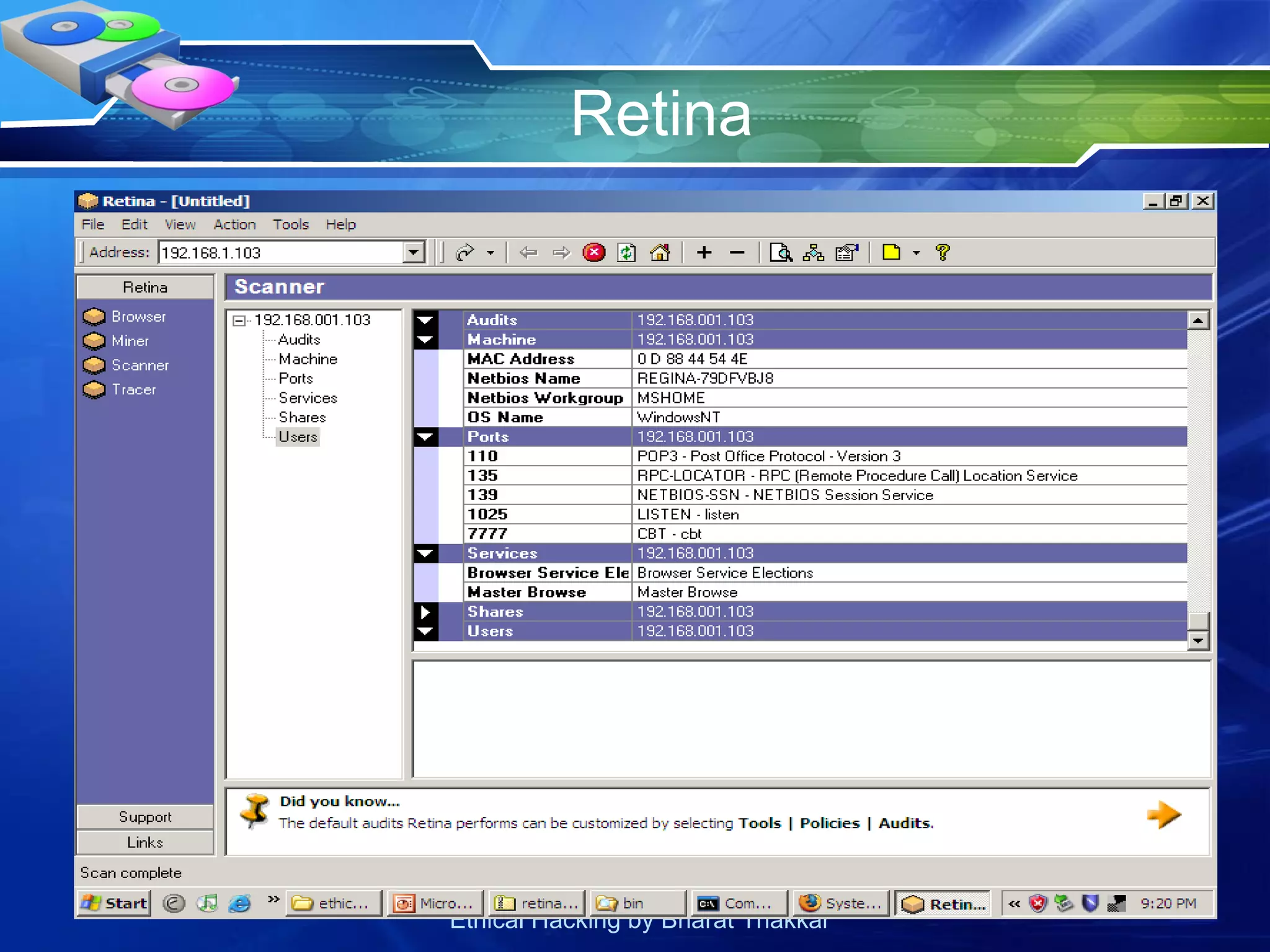Retina 