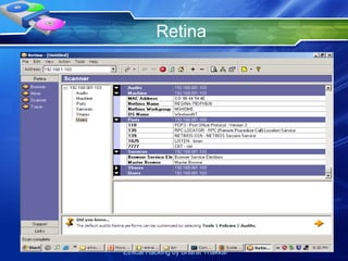 Retina 