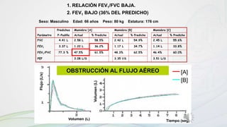 Volumen (L) Tiempo (seg)
Sexo: Masculino Edad: 66 años Peso: 80 kg Estatura: 176 cm
Predichos Maniobra [A] Maniobra [B] Maniobra [C]
Parámetro P-Padilla Actual % Predicho Actual % Predicho Actual % Predicho
FVC 4.41 L 2.58 L 58.5% 2.42 L 54.9% 2.45 L 55.6%
FEV1 3.37 L 1.22 L 36.2% 1.17 L 34.7% 1.14 L 33.8%
FEV1/FVC 77.3 % 47.5% 61.5% 48.3% 62.5% 46.4% 60.0%
PEF 3.08 L/S 3.35 l/S 3.51 L/S
[A]
[B]
Volumen(L)
Flujo(L/s)
1. RELACIÓN FEV1/FVC BAJA.
2. FEV1 BAJO (36% DEL PREDICHO)
OBSTRUCCIÓN AL FLUJO AÉREO
 