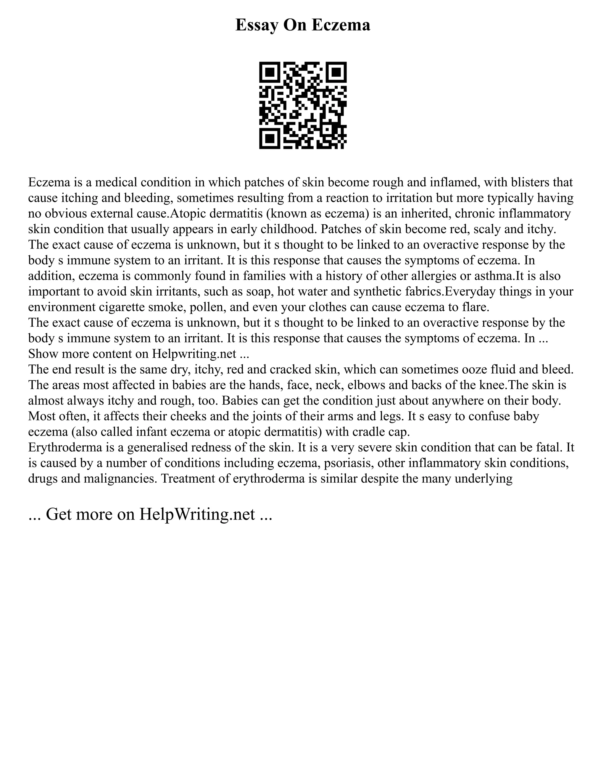Essay On Eczema
Eczema is a medical condition in which patches of skin become rough and inflamed, with blisters that
cause itching and bleeding, sometimes resulting from a reaction to irritation but more typically having
no obvious external cause.Atopic dermatitis (known as eczema) is an inherited, chronic inflammatory
skin condition that usually appears in early childhood. Patches of skin become red, scaly and itchy.
The exact cause of eczema is unknown, but it s thought to be linked to an overactive response by the
body s immune system to an irritant. It is this response that causes the symptoms of eczema. In
addition, eczema is commonly found in families with a history of other allergies or asthma.It is also
important to avoid skin irritants, such as soap, hot water and synthetic fabrics.Everyday things in your
environment cigarette smoke, pollen, and even your clothes can cause eczema to flare.
The exact cause of eczema is unknown, but it s thought to be linked to an overactive response by the
body s immune system to an irritant. It is this response that causes the symptoms of eczema. In ...
Show more content on Helpwriting.net ...
The end result is the same dry, itchy, red and cracked skin, which can sometimes ooze fluid and bleed.
The areas most affected in babies are the hands, face, neck, elbows and backs of the knee.The skin is
almost always itchy and rough, too. Babies can get the condition just about anywhere on their body.
Most often, it affects their cheeks and the joints of their arms and legs. It s easy to confuse baby
eczema (also called infant eczema or atopic dermatitis) with cradle cap.
Erythroderma is a generalised redness of the skin. It is a very severe skin condition that can be fatal. It
is caused by a number of conditions including eczema, psoriasis, other inflammatory skin conditions,
drugs and malignancies. Treatment of erythroderma is similar despite the many underlying
... Get more on HelpWriting.net ...
 