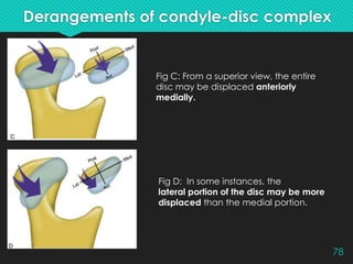 Temporomandibular Dysfunctions – Part 1(Etiology, Sign and Symptoms) | PPTX