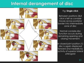 Temporomandibular Dysfunctions – Part 1(Etiology, Sign and Symptoms) | PPTX