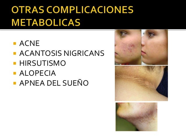 Las vitaminas de la caída de los cabello aevit las revocaciones para los cabellos