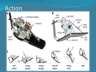 BIONICS | PPTX