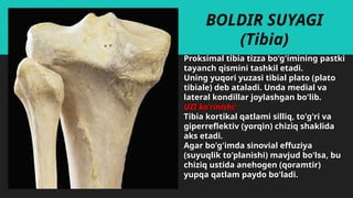 Tibia Proksimal Ultrasound Examination Techniques and Anatomy of the Knee Joint | PPTX