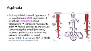 Asphyxia
• Prolonged fetal stress & hypoxemia 
↓ in pulmonary VEGF expression 
structural remodeling of pul
vasculature  increased muscularity
in PA  muscle extends to the vessels
surrounding the alveoli (normally,
muscular pulmonary arteries rarely
extends beyond the terminal
bronchiole)  increased PAP  PPHN.
(Ref: Lessus et al. 2001, Grover et al. 2003)
 