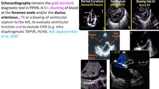 Echocardiography remains the gold standard
diagnostic tool in PPHN. A R-L shunting of blood
at the foramen ovale and/or the ductus
arteriosus , TR or a bowing of ventricular
septum to the left, to evaluate ventricular
function and to exclude CHD (e.g. infra
diaphragmatic TAPVR, HLHS). Ref: Jayasree Nair
et al. 2015
 