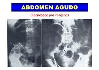 ABDOMEN AGUDOABDOMEN AGUDO
Diagnóstico por imágenes
 