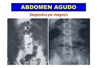 ABDOMEN AGUDOABDOMEN AGUDO
Diagnóstico por imágenes
 