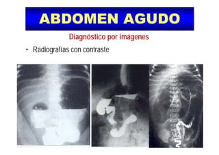 ABDOMEN AGUDOABDOMEN AGUDO
Diagnóstico por imágenes
• Radiografías con contraste
 