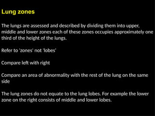 Chest Radiographic Anatomy for radiology rotation | PPTX