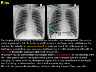 Chest Radiographic Anatomy for radiology rotation | PPTX
