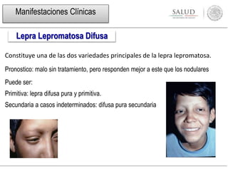 Constituye una de las dos variedades principales de la lepra lepromatosa.
Pronostico: malo sin tratamiento, pero responden mejor a este que los nodulares
Puede ser:
Primitiva: lepra difusa pura y primitiva.
Secundaria a casos indeterminados: difusa pura secundaria
Manifestaciones Clínicas
Lepra Lepromatosa Difusa
 