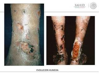 EVOLUCION HUMEDA
 