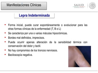 Manifestaciones Clínicas
• Forma inicial, puede curar expontáneamente o evolucionar para las
otras formas clínicas de la enfermedad (T, B o L)
• Se caracteriza por una o varias máculas hipocrómicas.
• Bordes mal definidos, imprecisos.
• Puede ocurrir apenas alteración de la sensibilidad térmica con
conservación del dolor y tactil.
• No hay compromiso de los troncos nerviosos.
• Baciloscopía negativa.
Lepra Indeterminada
 