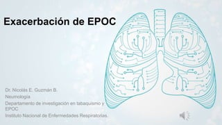 Exacerbación de EPOC
Dr. Nicolás E. Guzmán B.
Neumología
Departamento de investigación en tabaquismo y
EPOC
Instituto Nacional de Enfermedades Respiratorias.
 