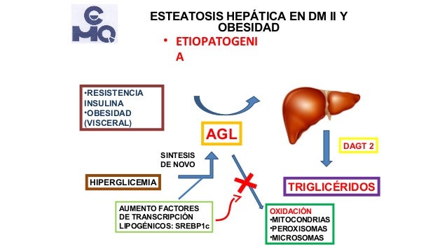 Esteatosis hepática en obesidad y diabetes tipo 2 Esteatosis hepática en obesidad y diabetes tipo 2