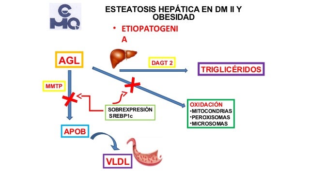 Esteatosis hepática en obesidad y diabetes tipo 2 Esteatosis hepática en obesidad y diabetes tipo 2