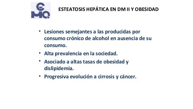 Esteatosis hepática en obesidad y diabetes tipo 2 Esteatosis hepática en obesidad y diabetes tipo 2