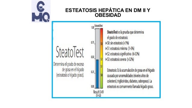 Esteatosis hepática en obesidad y diabetes tipo 2 Esteatosis hepática en obesidad y diabetes tipo 2