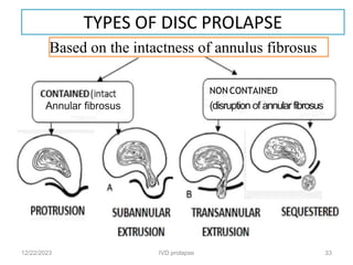 002_Intervertebral-disc-prolapse ppt.pdf