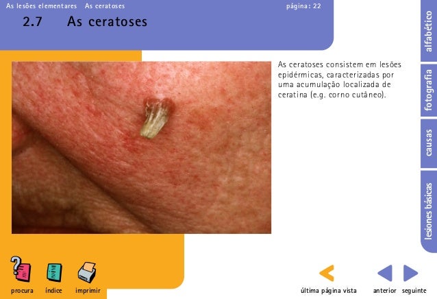 DERMATO LES ES ELEMENTARES dermato-les-es-elementares