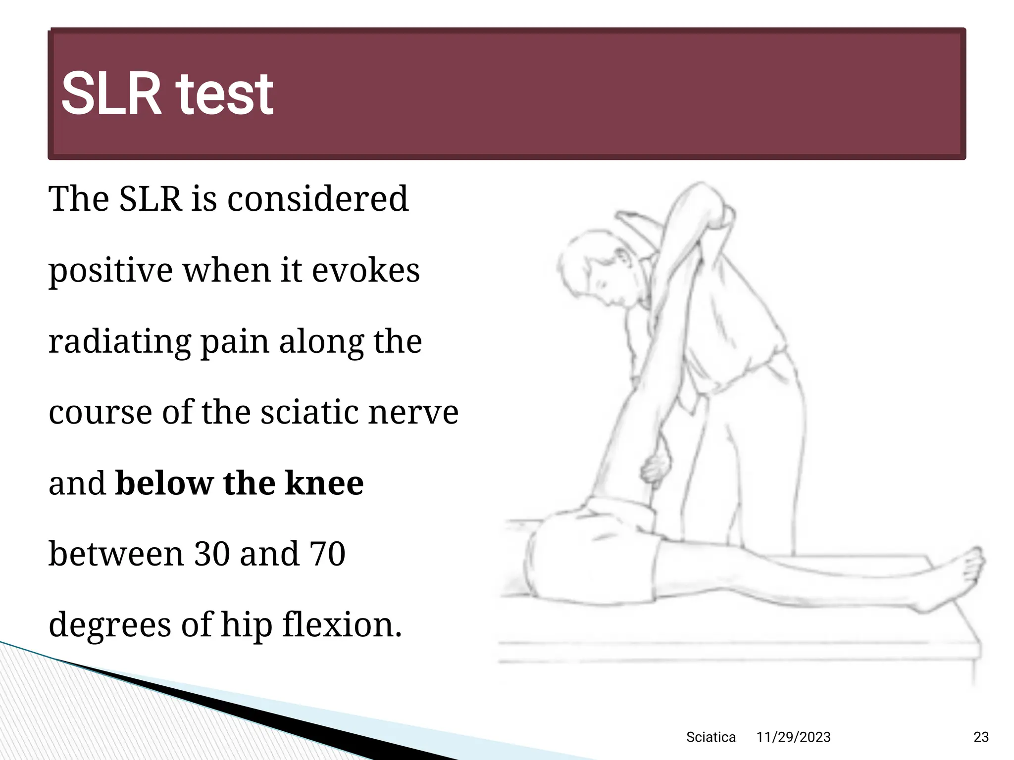 11/29/2023 23
SLR test
The SLR is considered
positive when it evokes
radiating pain along the
course of the sciatic nerve
and below the knee
between 30 and 70
degrees of hip flexion.
Sciatica
 