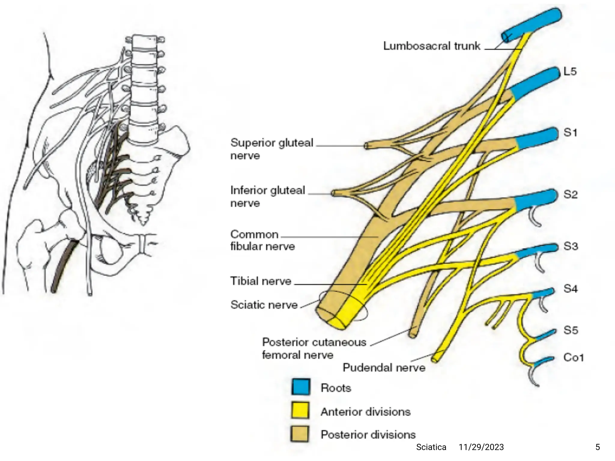 11/29/2023 5
Sciatica
 