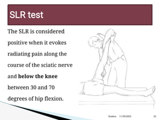 11/29/2023 23
SLR test
The SLR is considered
positive when it evokes
radiating pain along the
course of the sciatic nerve
and below the knee
between 30 and 70
degrees of hip flexion.
Sciatica
 